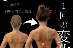COCOFIT聖蹟桜ヶ丘店の2ヶ月集中ダイエットモニター・エンダモロジーアライアンス施術イメージ